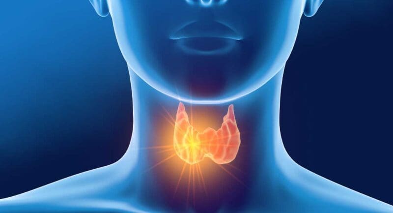 Is Your Thyroid Gland Underactive? - Dr Sandra Cabot MD