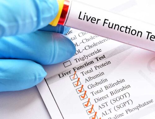 Liver Function Tests – Understanding Your Blood Test Results