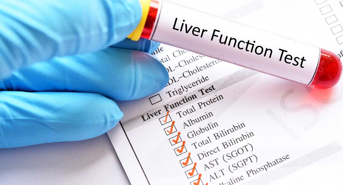 Liver Function Tests Understanding Your Blood Test Results Dr 