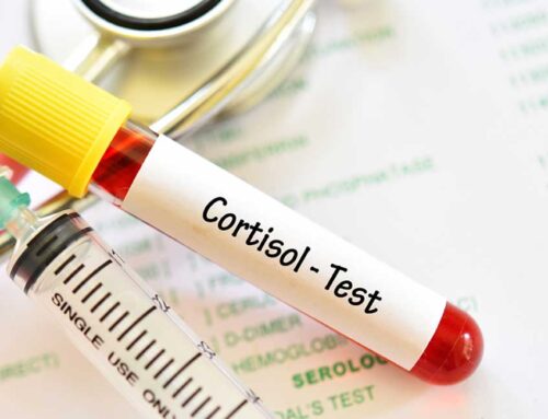 Adrenal Function Tests – Understanding Your Blood Test Results