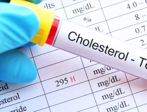 Cholesterol Test – Understanding Your Blood Test Results